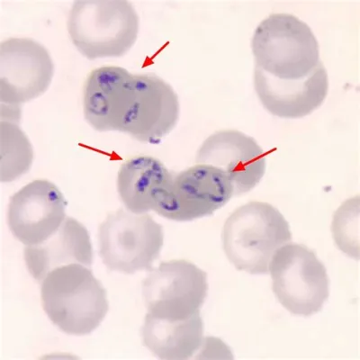  Babesia: Een parasiet die je rode bloedcellen omtovert tot een dansvloer voor infectie!