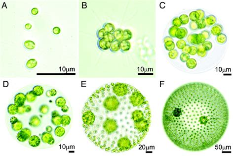  Folliculina! Een microscopische eencellig die zich met elegantie vermenigvuldigt