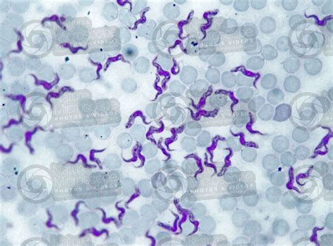  Trypanosoma! Een microscopische rover die de wereld van binnenuit verovert