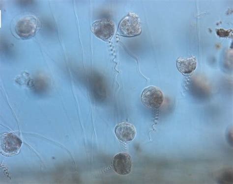 Vorticella! Een Microscopische Dierenheld Met een Verrassend Snelle Rotatiesnelheid